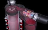 Damping technology